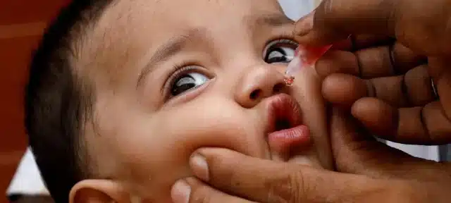 Second Polio Case in Two Days Raises Alarm