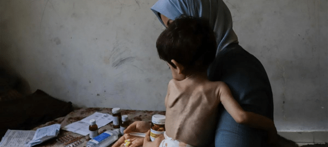 Starving Children Perish In Parents Arms Amid Gaza Spreading Famine