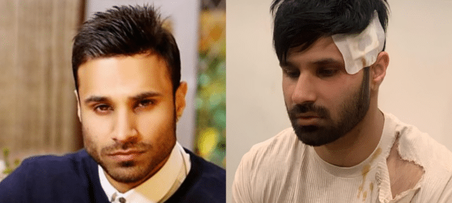 YouTuber Rahim Pardesi Discloses Injuries To Fans Following A Violent Assault