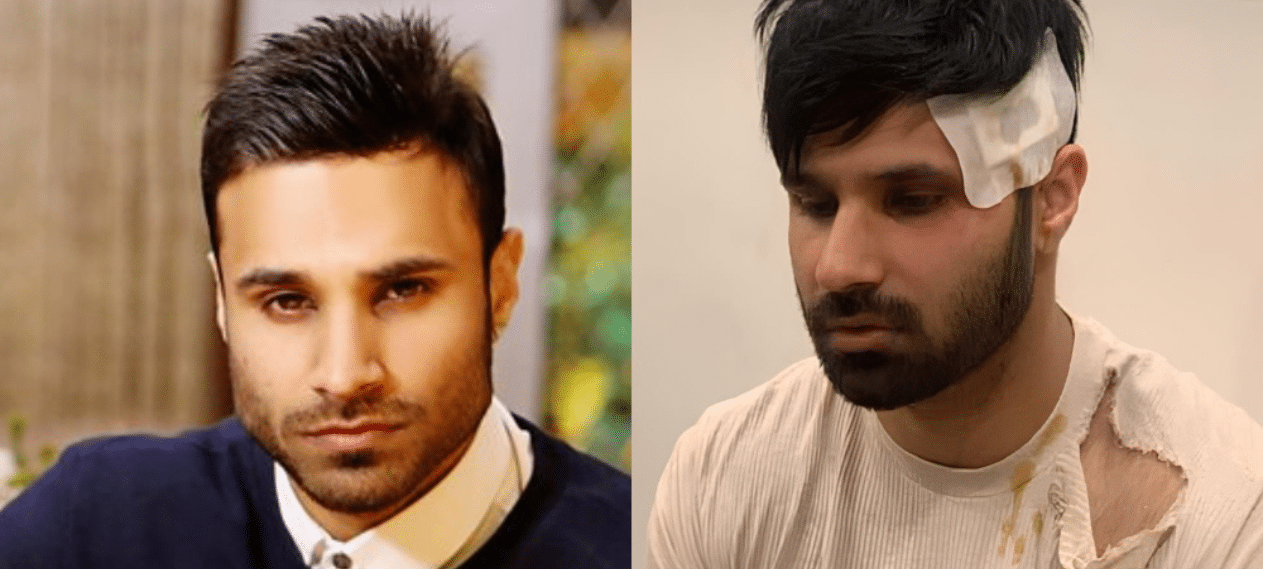 YouTuber Rahim Pardesi Discloses Injuries To Fans Following A Violent Assault