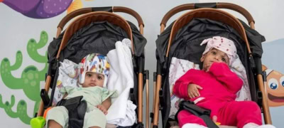 Pakistani Conjoined Twins Successfully Separated After 14-Hour Surgery in Turkiye