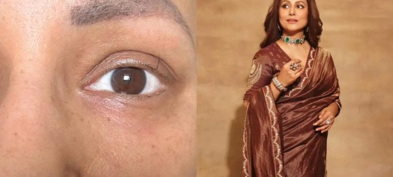 Hina Khan Shares Photo of Her 'Last Standing Eyelash' as She Approaches the End of Her Chemo Cycle