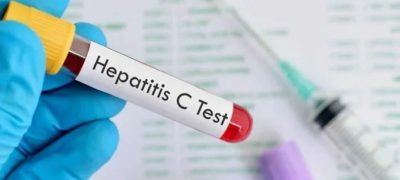 Government Launches Pilot Program to Combat Hepatitis C in Gilgit-Baltistan