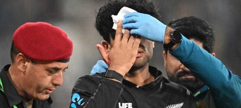 Rachin Ravindra Recovering from Forehead Injury During Tri-Series Clash