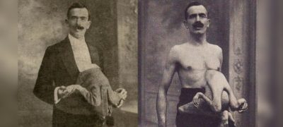 Did You Know About Jean Liberra, the Double-Bodied Man?