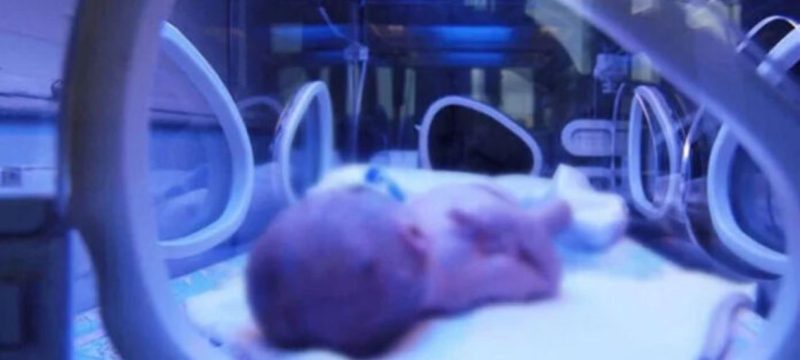 Infant Severely Burned as Incubator 'Overheats' at Lahore Hospital