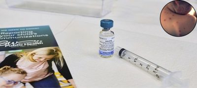 South Korea Reports Highest Measles Surge in Six Years Amid Global Health Concerns