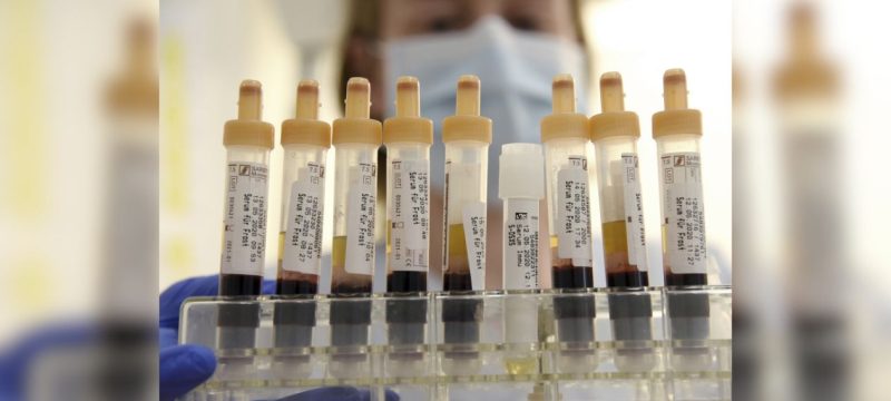 Rare ‘Gwada Negative’ Blood Group Discovered in France in Genetic Breakthrough