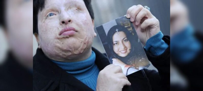 A Story of Pain, Courage & Retribution: Iranian Woman Demands Eye-for-an-Eye Justice After Acid Attack