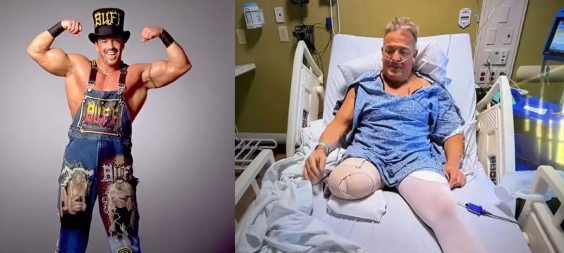 Buff Bagwell Shares His Journey to Leg Amputation After Car Accident