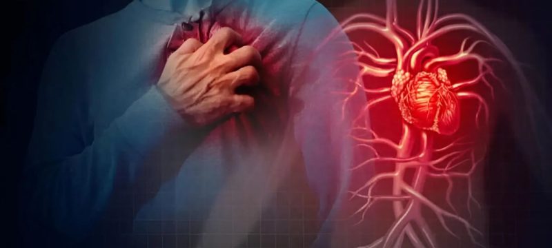 Nearly 50pc of Pakistan’s Heart Attack Patients Are Under 49, Study Finds