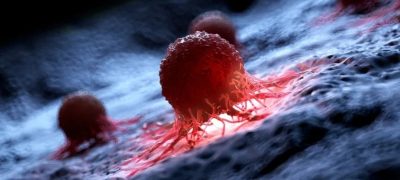 Breakthrough Scientists Use Light to Destroy 99% of Cancer Cells Without Chemo or Radiation