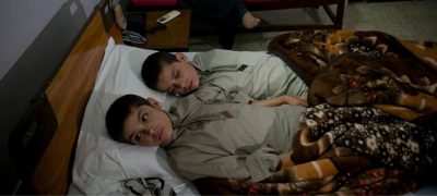Two Brothers Diagnosed With Rare Nighttime Paralysis Condition