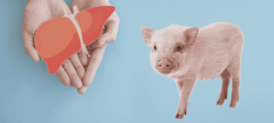 China Makes History With First Pig-To-Human Liver Transplant