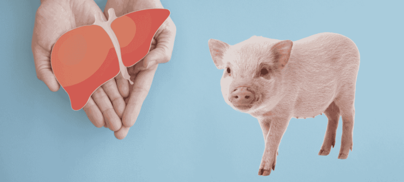 China Makes History With First Pig-To-Human Liver Transplant