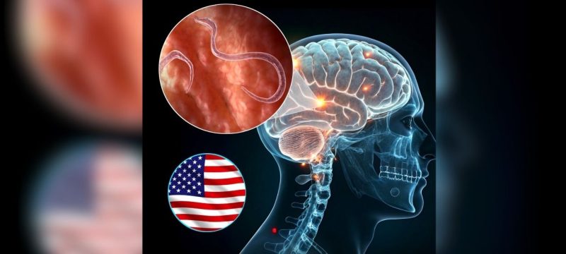 ‘Dimagh Ka Keera’ Literally Spotted! Americans Carry a Brain Parasite That Can Alter Your Mood or Behaviour