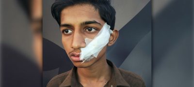 Child Injured by Kite String in Lahore Street Tragedy Case