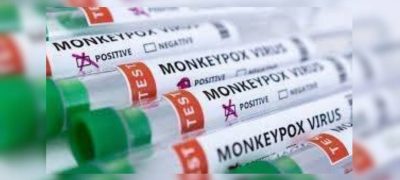 Monkeypox Cases Rise in Faisalabad as Health Officials Warn Public