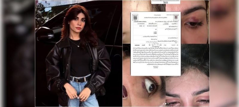 Model Iqra Nasir Files FIR Alleging Assault by Ex-Husband