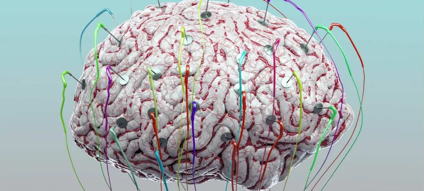 Is Preserving the Human Brain Possible New Research Sparks Debate
