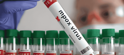 After Fatal Cases in Khairpur, Sindh Orders Monkeypox Emergency Units