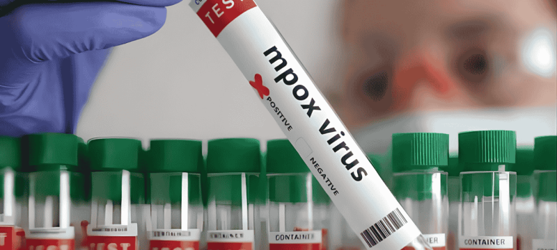 After Fatal Cases in Khairpur, Sindh Orders Monkeypox Emergency Units