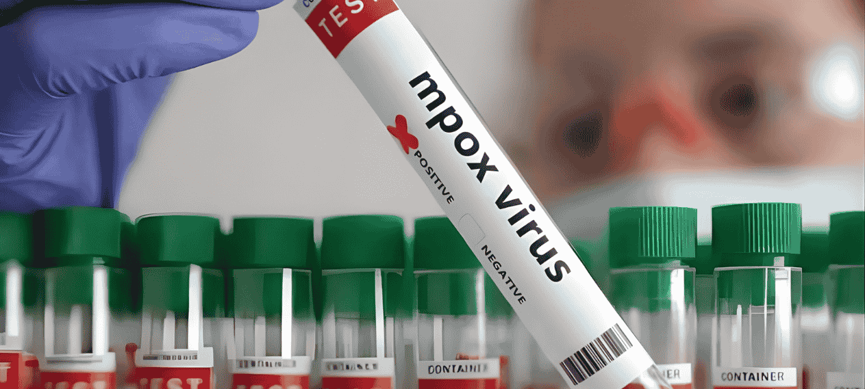 After Fatal Cases in Khairpur, Sindh Orders Monkeypox Emergency Units