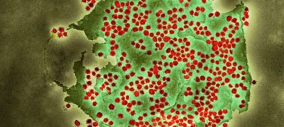 New COVID Variant Detected Across 23 Countries