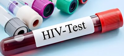 Pakistan Tightens HIV Screening Measures After Rising Cases