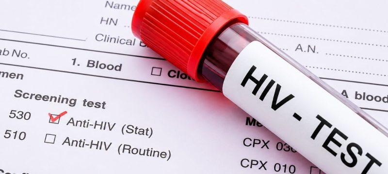 Pakistan to Conduct HIV Screening of Deported Passengers at Airports