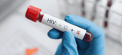 Mass HIV Testing Planned in Karachi After Child HIV Cases Raise Concerns