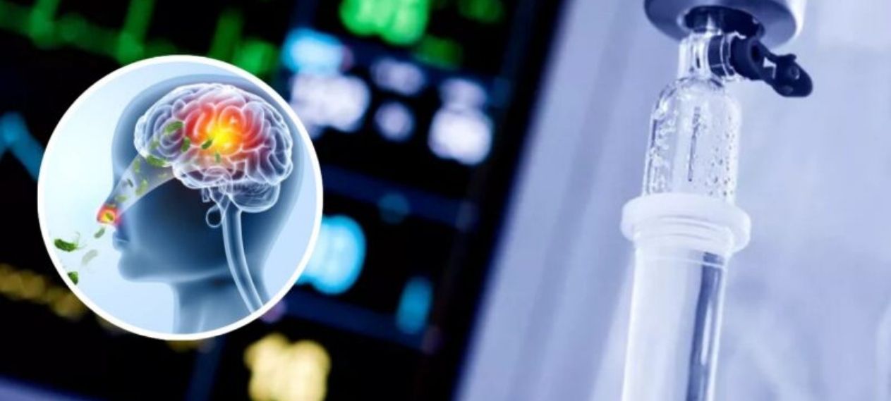 Karachi Reports First Brain-Eating Amoeba Case of 2026