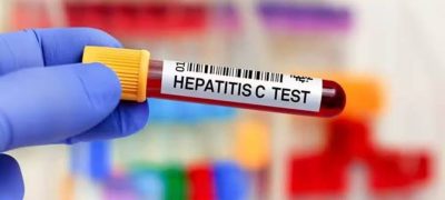 Hepatitis C Test To Be Made Mandatory For CNIC, Foreign Travel