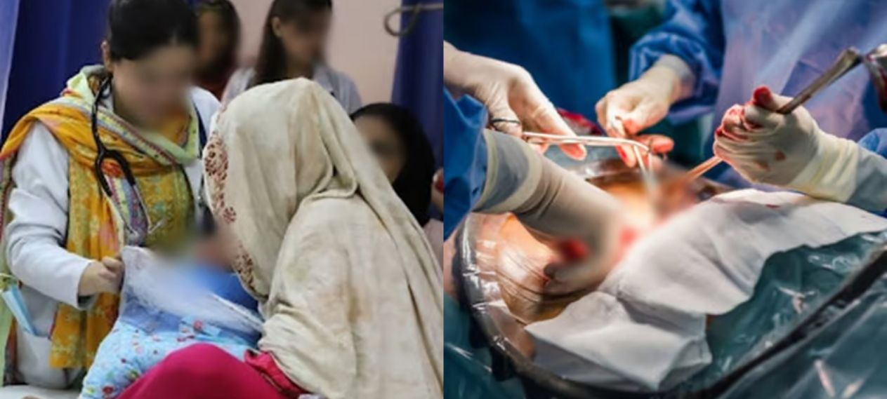 Karachi Woman Undergoes C-Section After Faking Pregnancy Amid Family Pressure